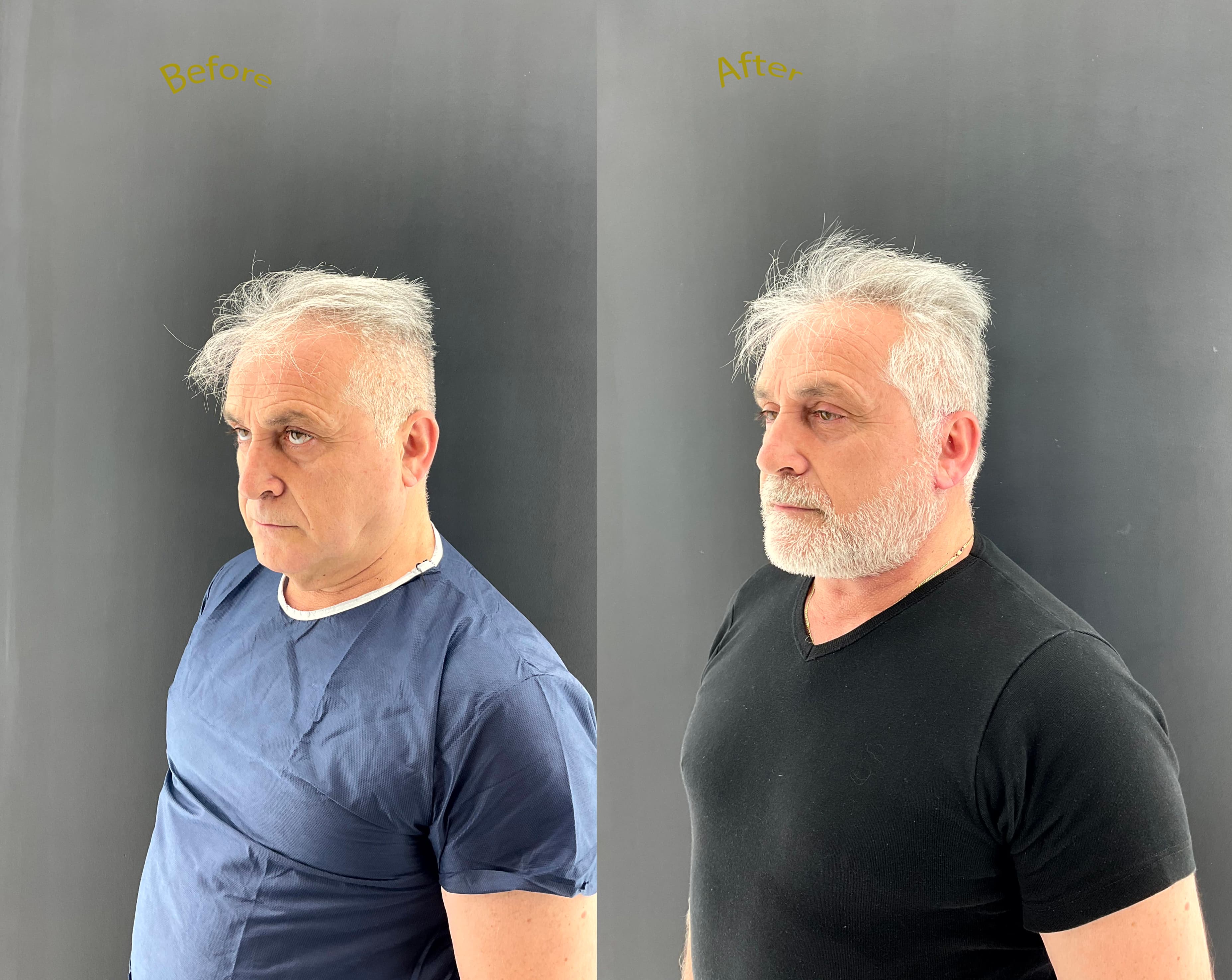 Second published facial rejuvenation outcome image from Face of Athens